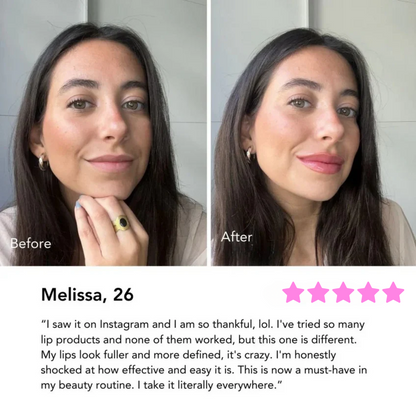 Velonix™ Peel-Off Lip Liner Stain